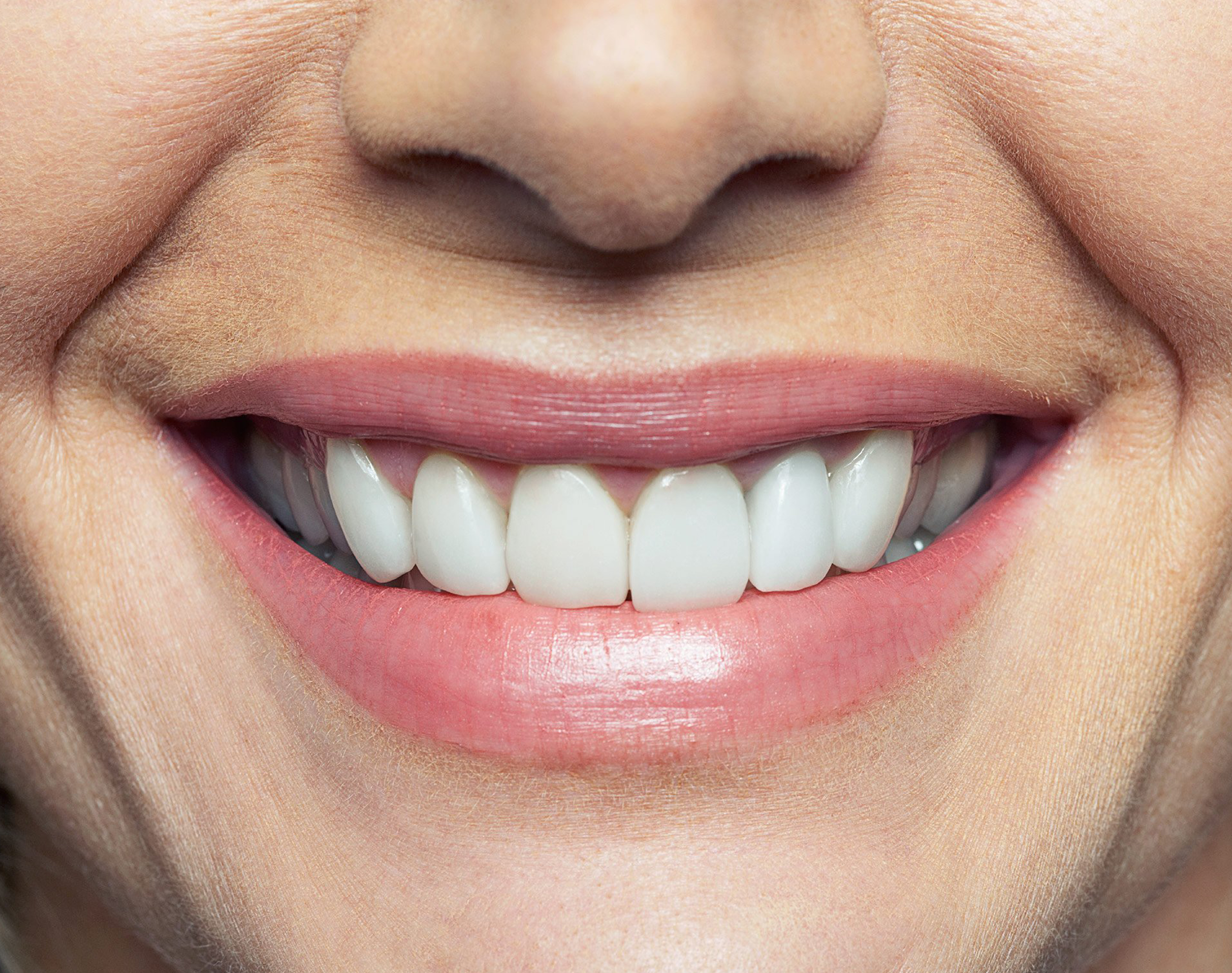 Клык фото зуба. Красивые зубы. Ровные зубы. Красивая форма зубов. Красивые ровные зубы.